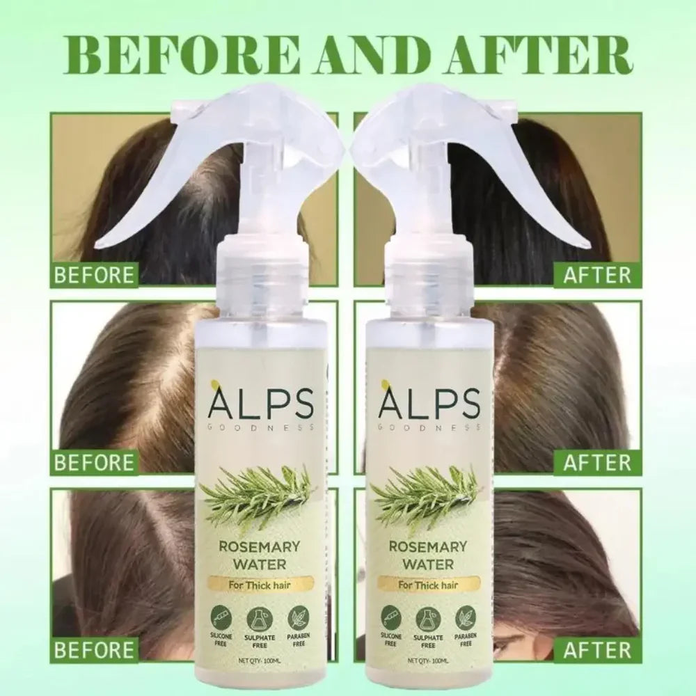 Rosemary Water Spray | For Hair Regrowth (Buy 1 Get 2 Free š)