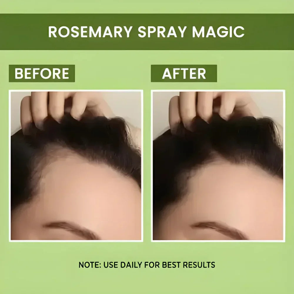 Rosemary Water Spray | For Hair Regrowth (Buy 1 Get 2 Free š)